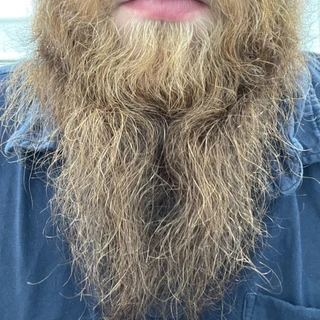 BeardedDadBod