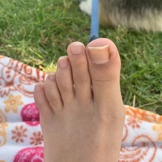 Camela Toe