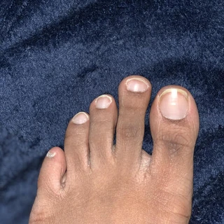 Chocolate Toes