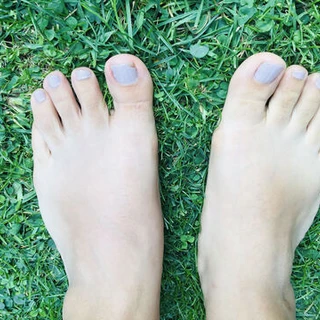 Mel Feet