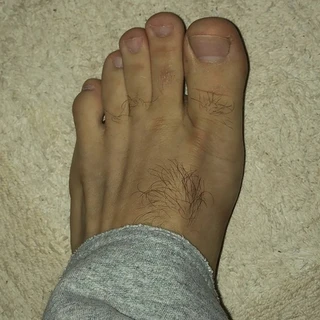 Feet.mg