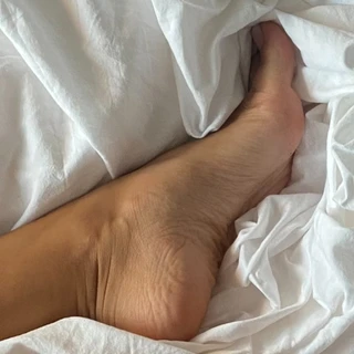 Birthmark Feet