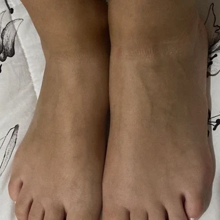 Hotfoots