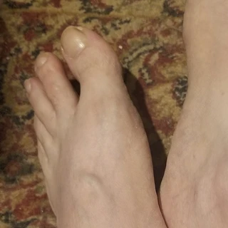 MeesterFeet