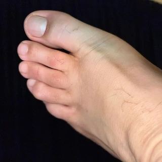 Melbfeet