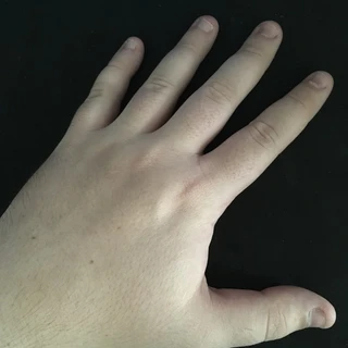 Only Fingers