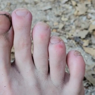 FEET OF THE PCT