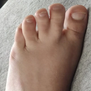 Syndactoes