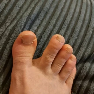 BigToeGuy