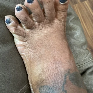 Ugly feet