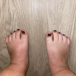 Small feet