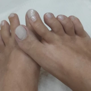 MissFeet