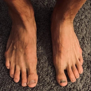 Athletic Feet